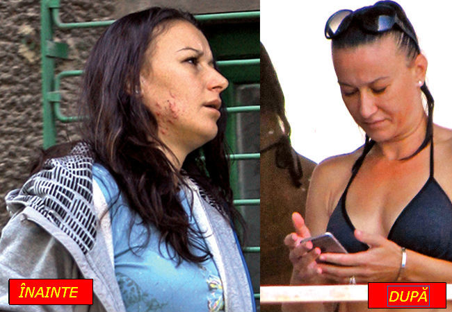 Raluca Sandu,  înainte şi după tratamentul împotriva acneei.
