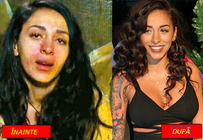 Ruby,  înainte şi după tratamentul împotriva acneei.