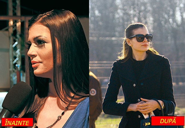 Monica Gabor,  înainte şi după tratamentul împotriva acneei.