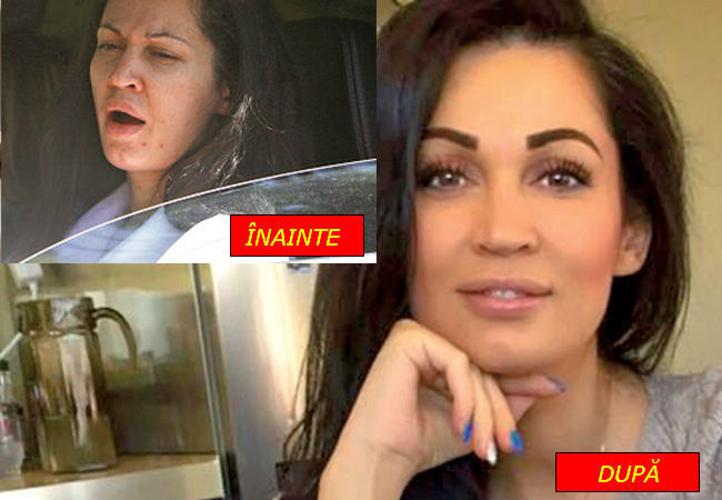 Nicoleta Luciu, înainte şi după tratamentul împotriva acneei.
