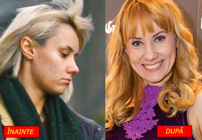 Oana Ioniţă,  înainte şi după tratamentul împotriva acneei.