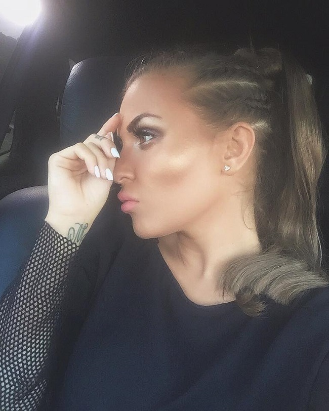 Oana Radu are o falcă umflată din cauza unei măsele de minte.