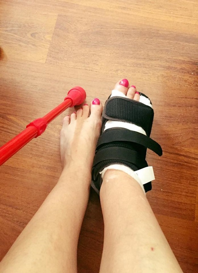 Rita Mureşan trebuie să meargă în cârje.