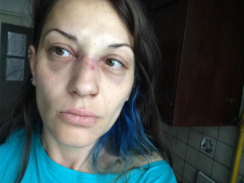 Cântăreaţa a fost bătută cu bestialitate