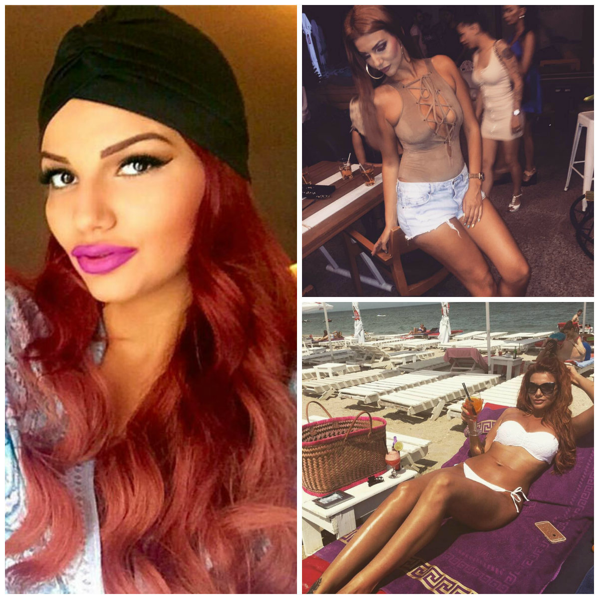 Loredana de la ”Insula Iubirii” şi-a mărit buzele.