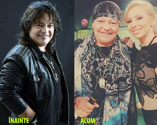 În prima imagine puteţi vedea cum arăta Leo Iorga înainte să fie diagnosticat cu cancer, iar în cea de-a doua, cum arată acum, după patru operaţii.