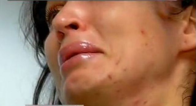 Vedeta Tv are, din nou, probleme cu tenul.