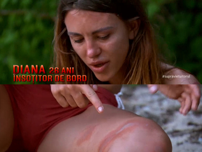 Diana Burnaz s-a accidentat în primul episod al emisiunii ”Supravieţuitorul”.