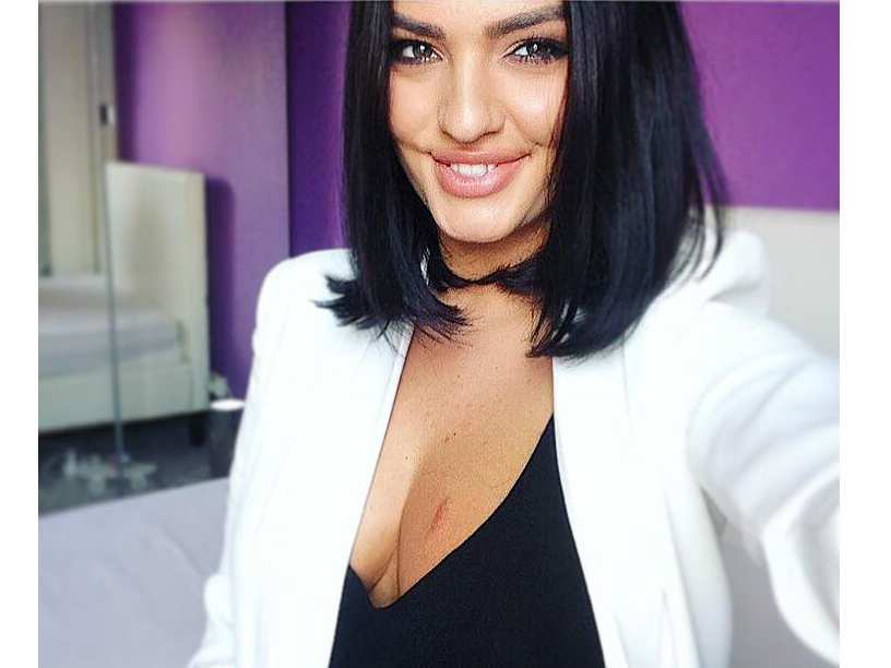 Diana a făcut publică această imagine în care e vizibilă o cicatrice