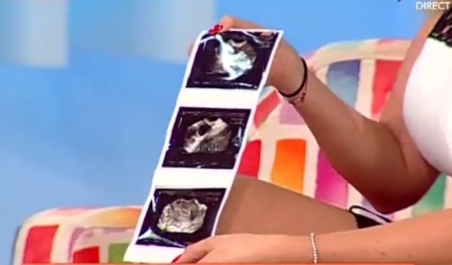 Roxana Ciuhulescu a prezentat ecografia la TV.