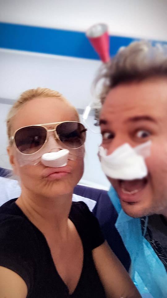 După sâni, Vica şi-a operat şi nasul.