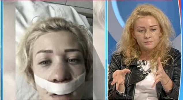 Sandra a fost desfigurată 