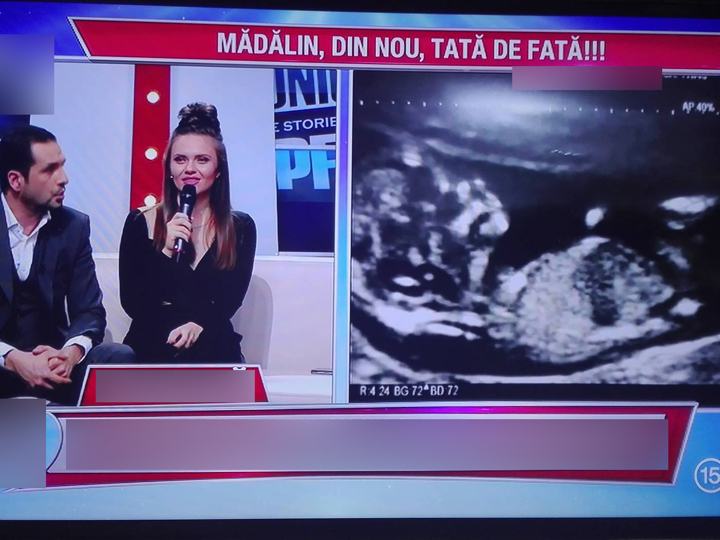 Mădălin Ionescu şi Cristina Şişcanu au făcut publică ecografia bebeluşului