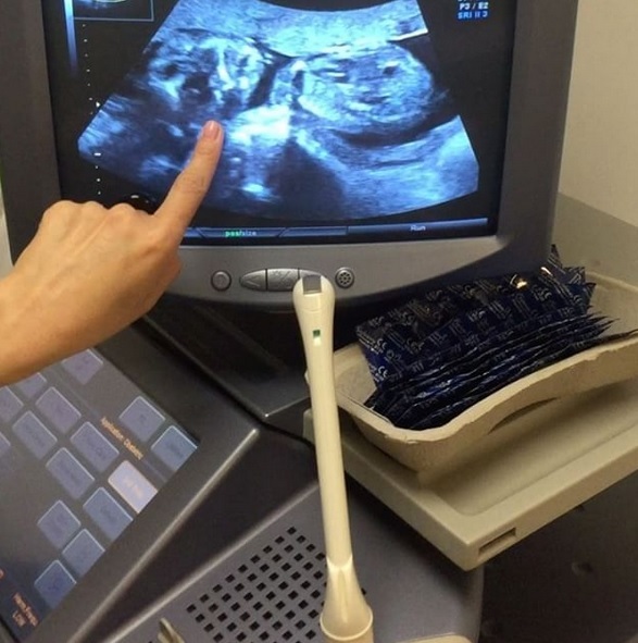 Mădălin şi Cristina au arătat tuturor imaginile de la ecografie