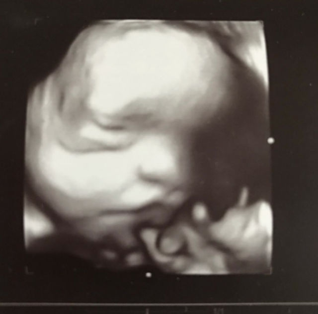 Actriţa Keshia Knight Pulliam a postat imaginea cu prima ecografie.