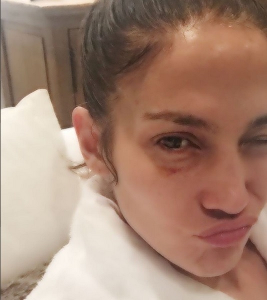 Din fericire, nu era vorba despre un abuz, ci despre o accidentare la sală.