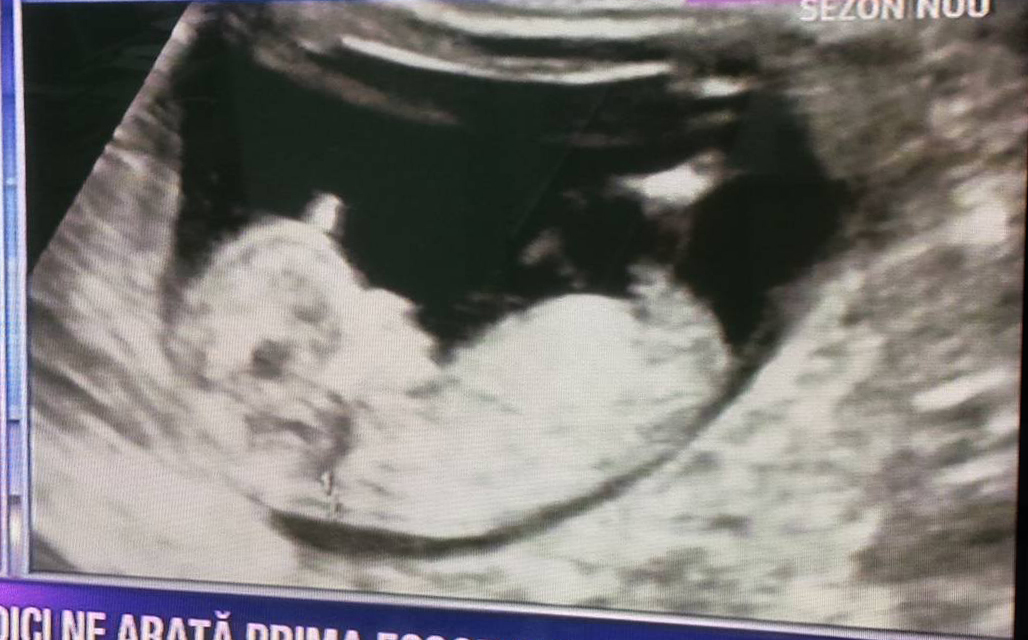 Ilinca Vandici le-a arătat tuturor prima imagine cu bebeluşul ei.