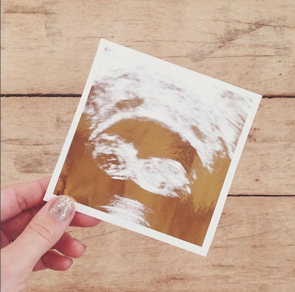 Ecografia cu viitorul bebeluş al actriţei