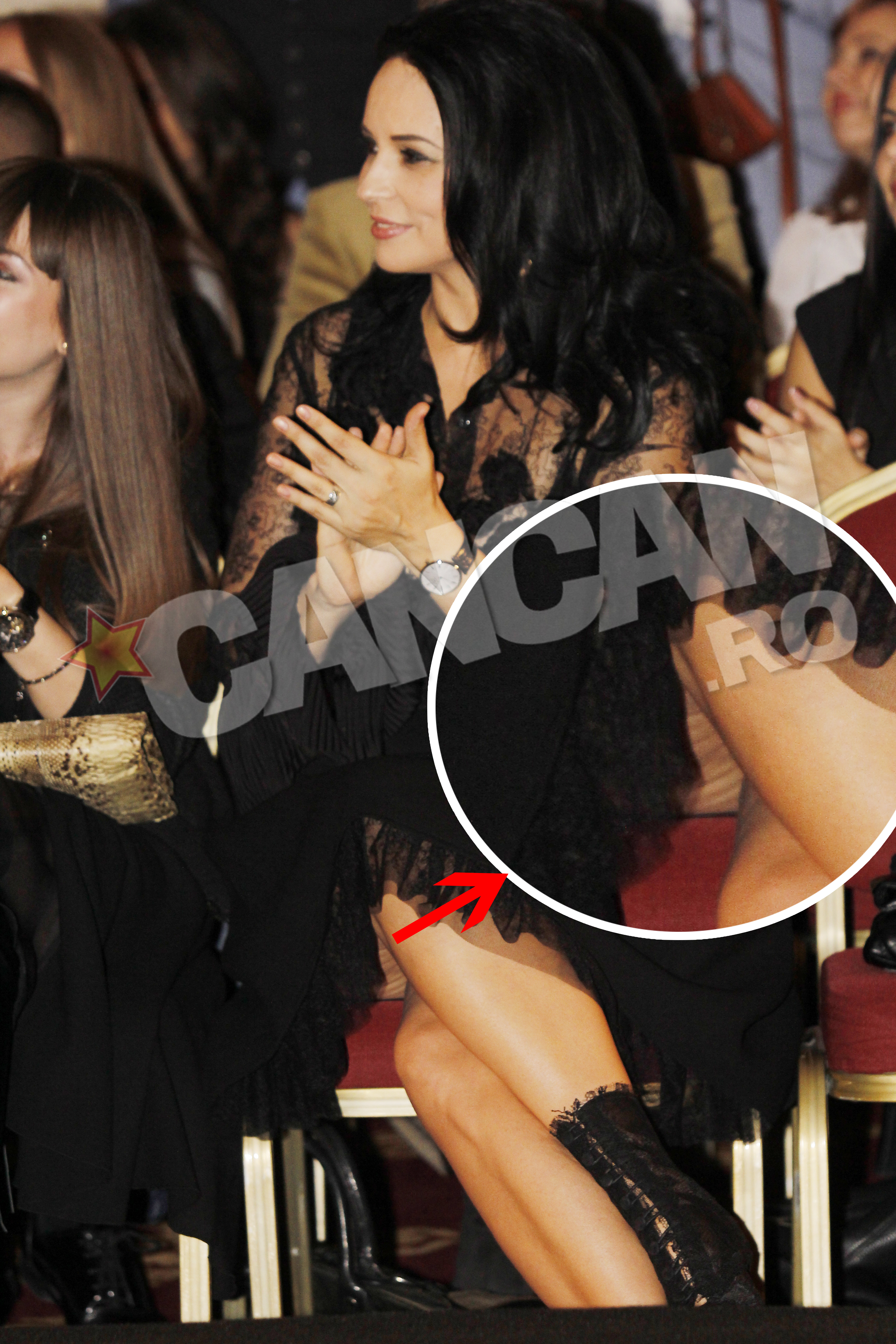 Intr-un moment de neatentie, Andreea Marin a dezvaluit lumii un aspect maiputin placut al trupului ei