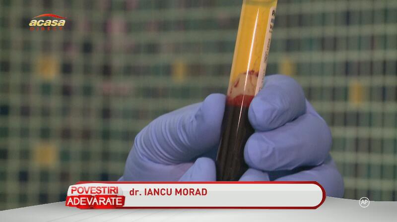 Cătălin Botezatu, extravagant până-n pânzele albe! Designerul face un tratament facial cu sânge, la fel ca Beckham!