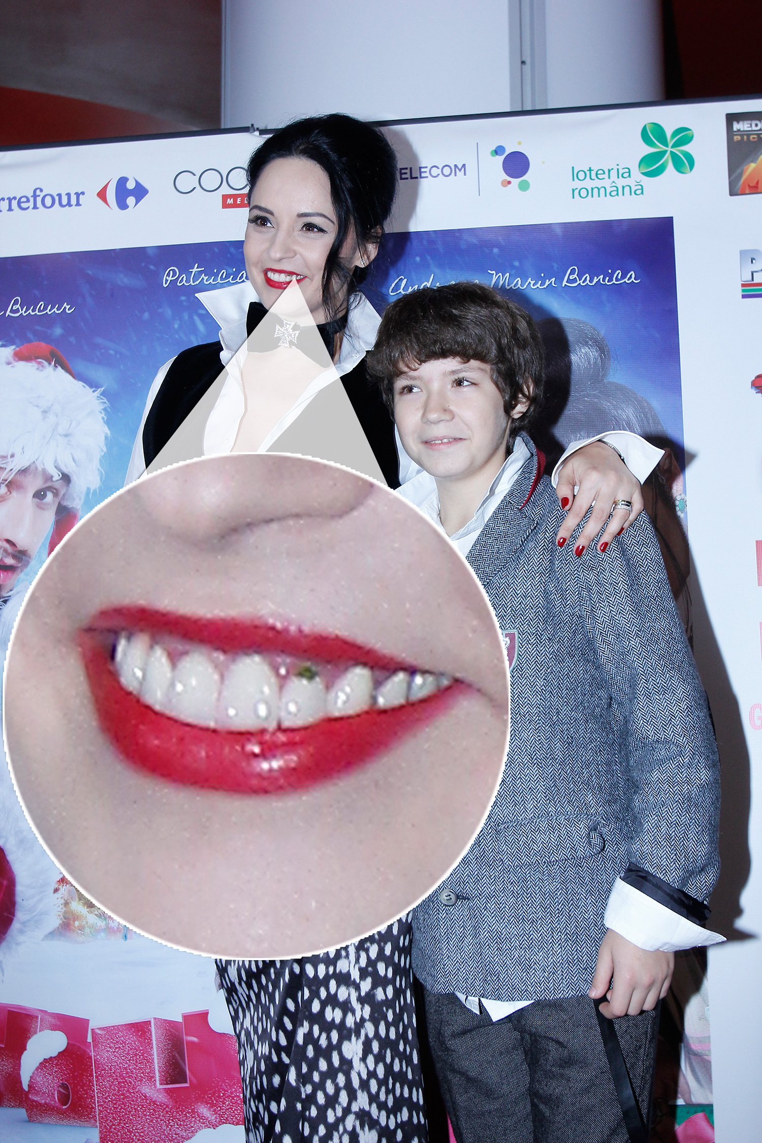 Andreea a zambit fara rezerve, nestiind ce se adaposteste pe incisivul ei