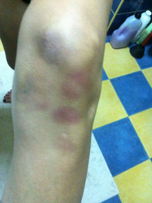 Antrenamentele insa i-au distrus picioarele