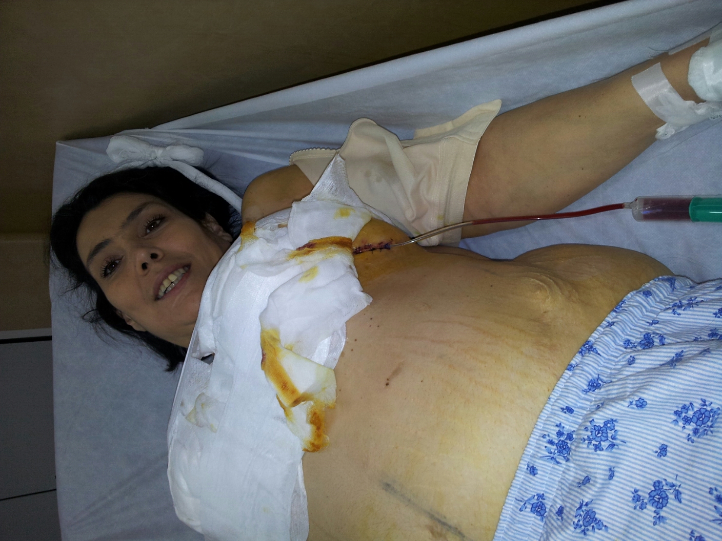 Fiica Andei Calugareanu a ajuns din nou pe mana medicilor, chinuita de perioada post-operatorie
