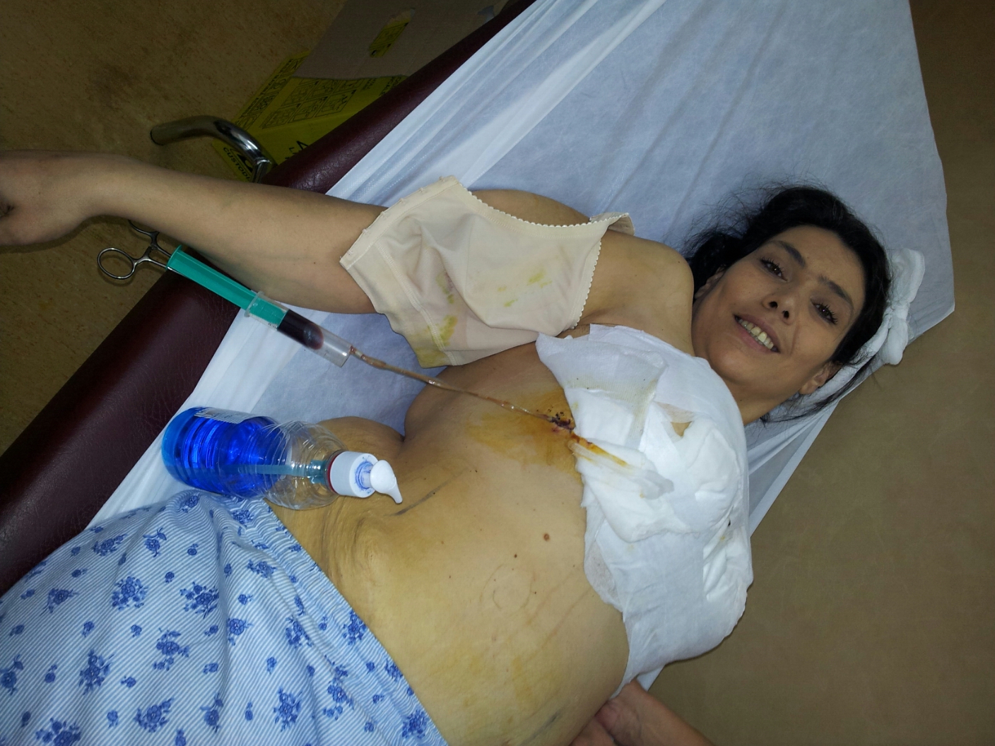 Ioana Tufaru merge la medic o data la cateva zile in speranta ca i se va vindeca rana de la sani