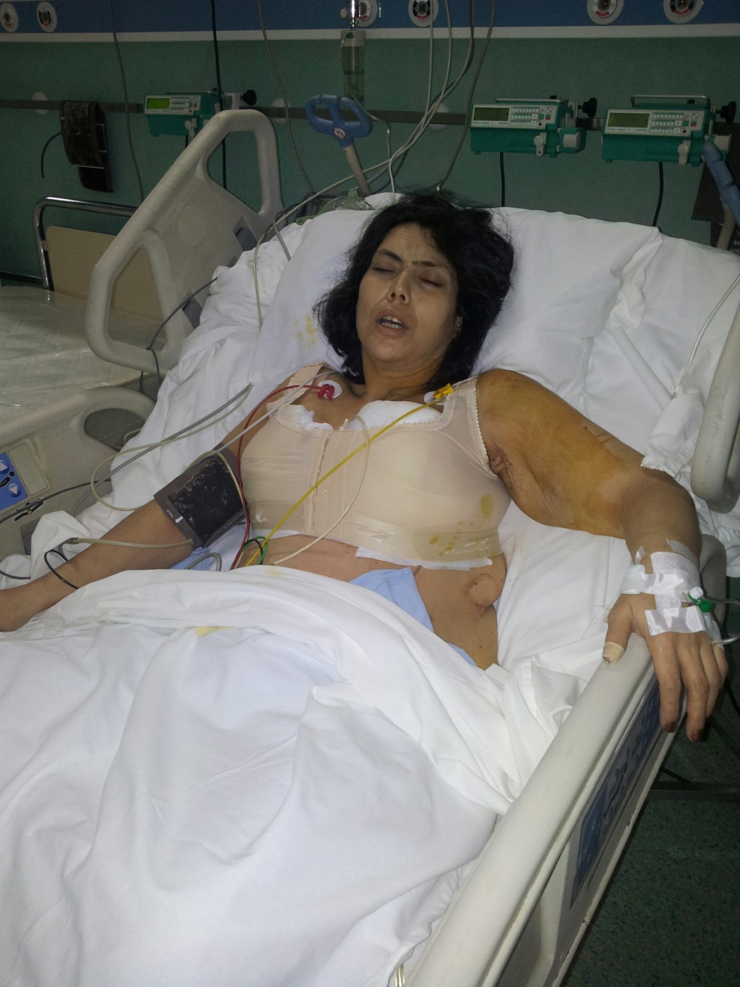 Fiica Andei Calugareanu inca are rana deschisa, motiv pentru care sufera enorma, atat fizic, cat si emotional