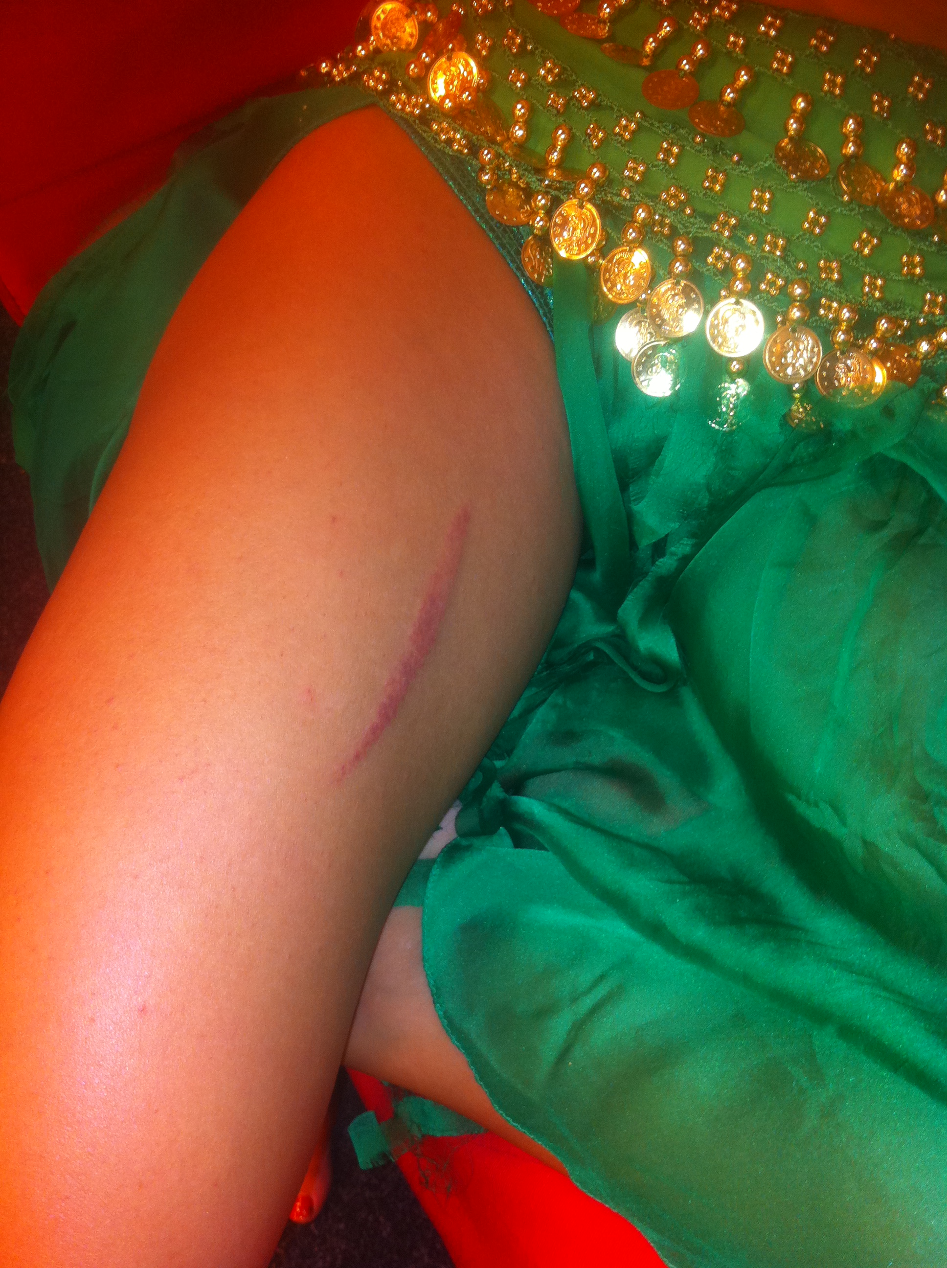 Narcisa i-a aplicat cateva lovituri, lasandu-i urme vizibile