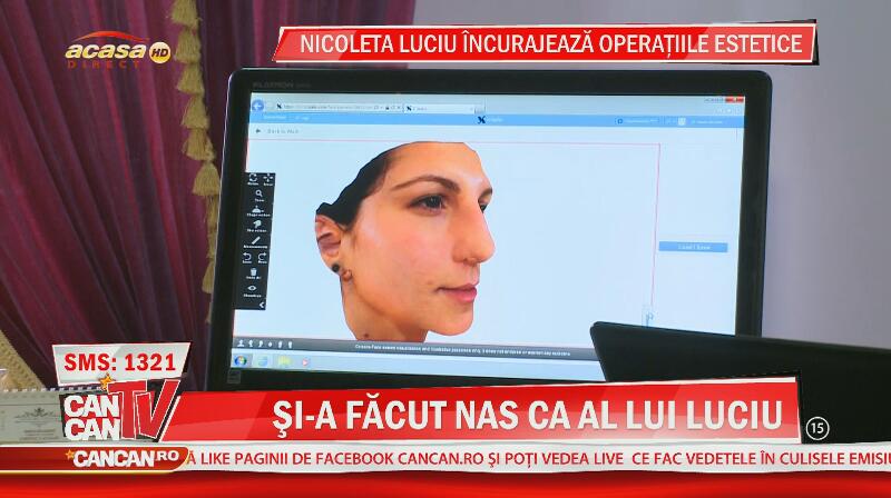 Cea mai mare fană a Nicoletei Luciu vrea să arate ca idolul ei! Denisa şi-a făcut nas ca al vedetei! Seamană?