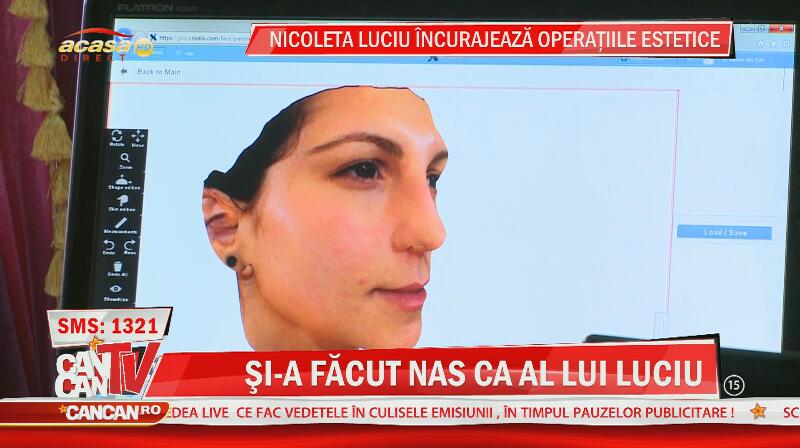 Cea mai mare fană a Nicoletei Luciu vrea să arate ca idolul ei! Denisa şi-a făcut nas ca al vedetei! Seamană?