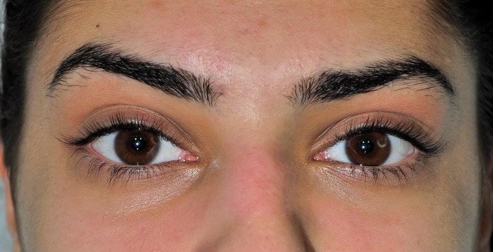 Inainte de atingerea miraculoasa a 