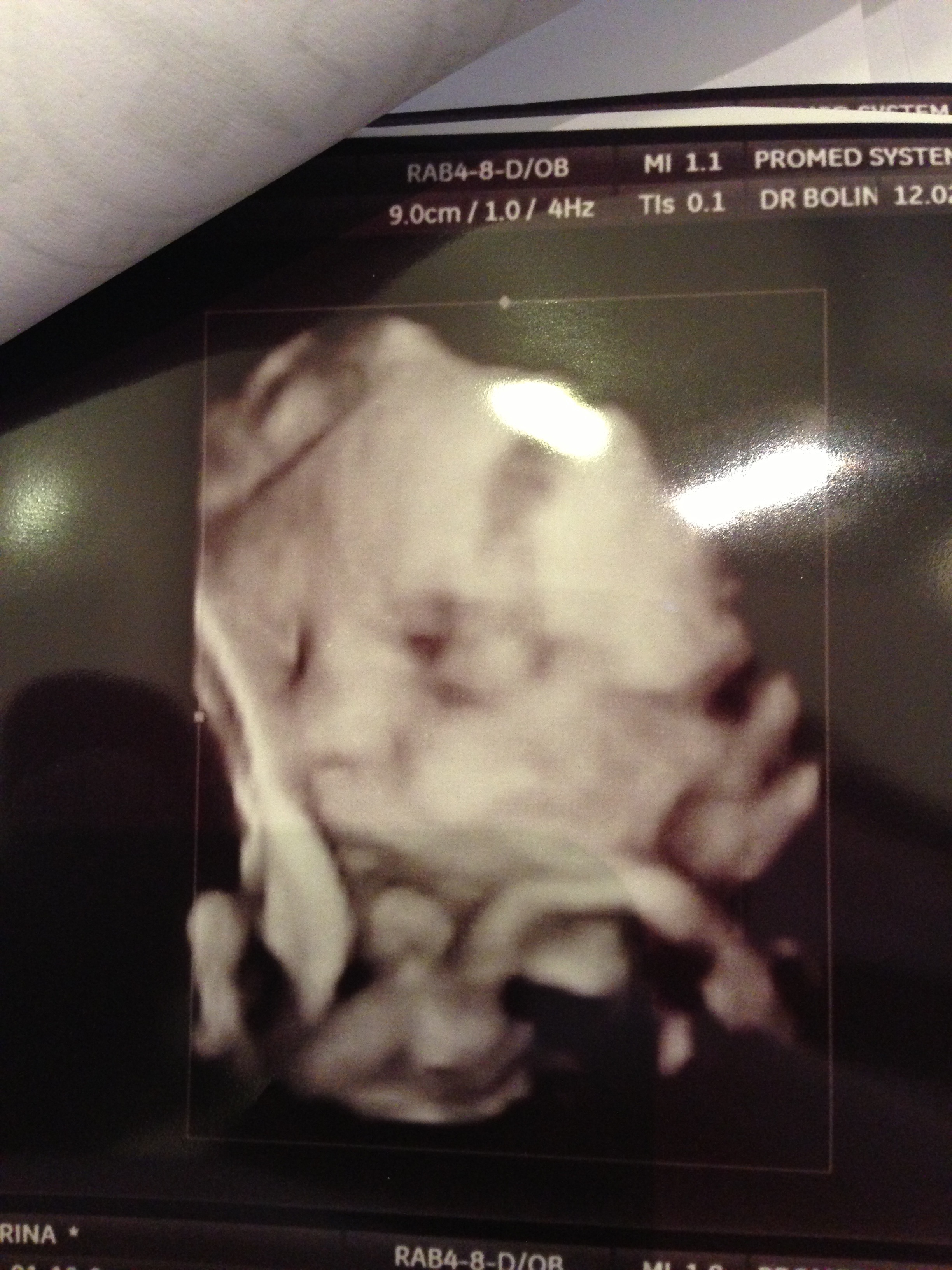 Corina si Eduard au facut toate analizele cu sfintenie