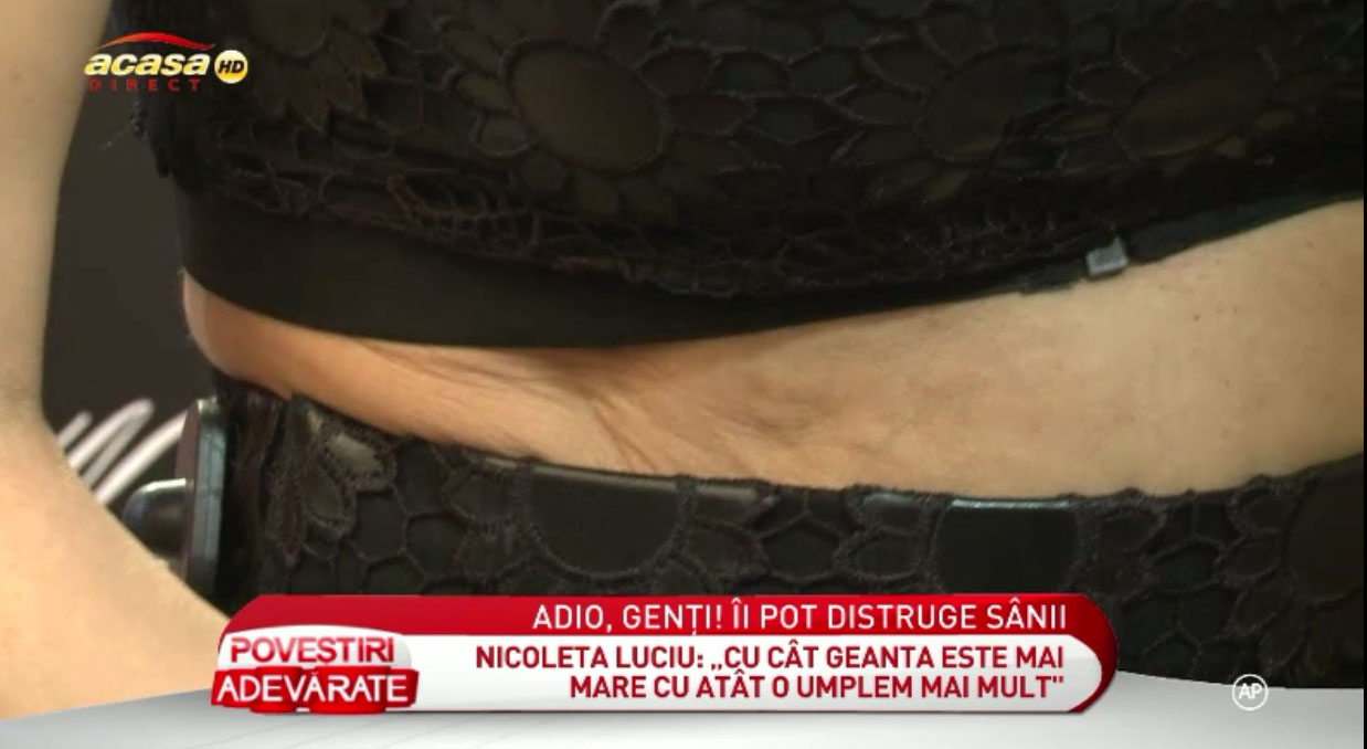 Pielea Nicoletei Luciu are un aspect inestetic