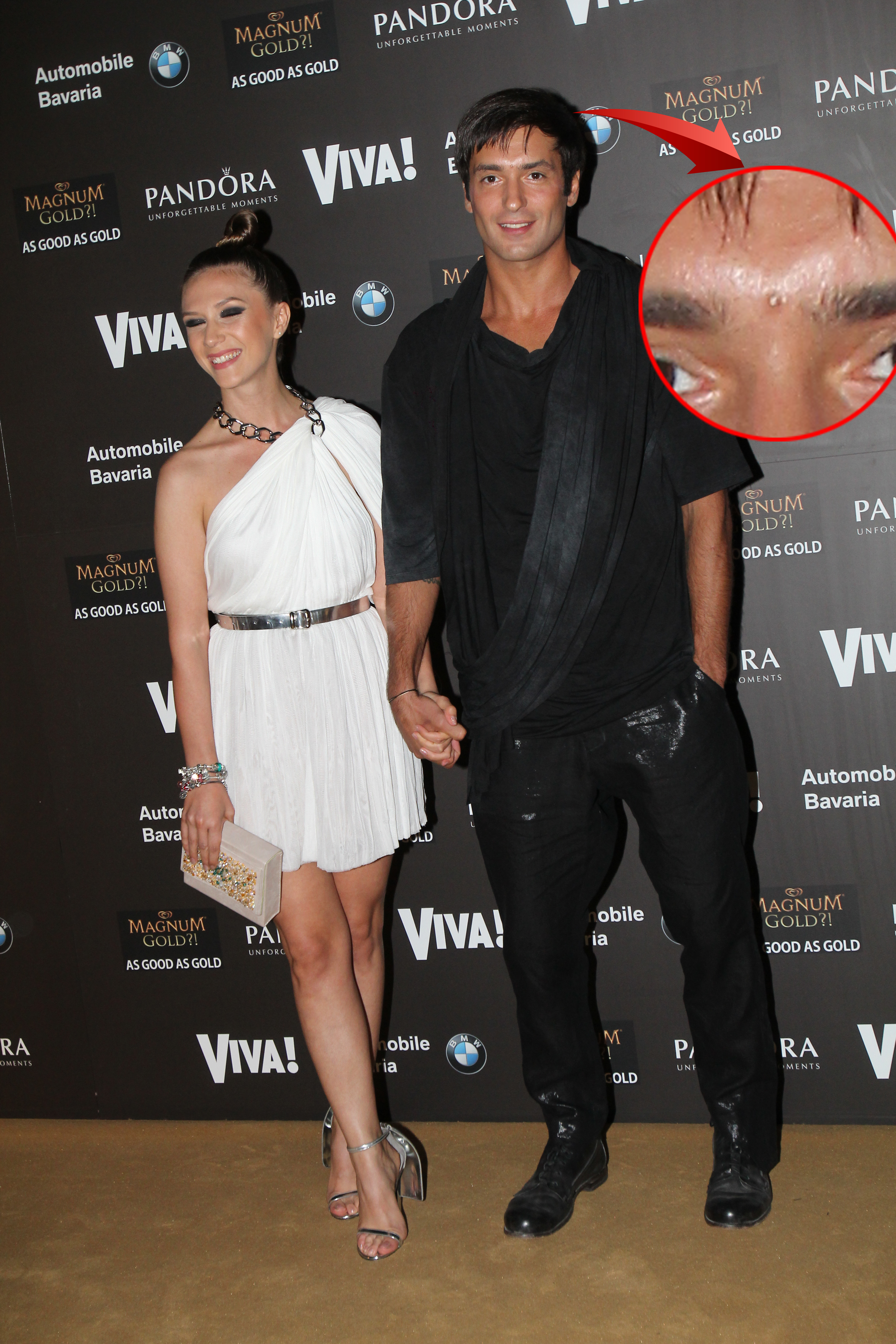 Radu Valcan are, bine pozitionata intre sprancene, o alunita de toata frumusetea