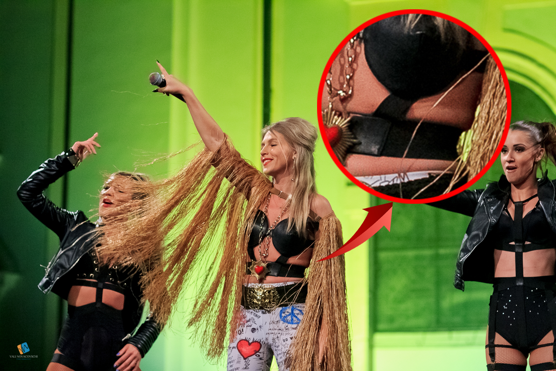 Corsetul foarte stramt lasa sa iasa surplusul de grasime