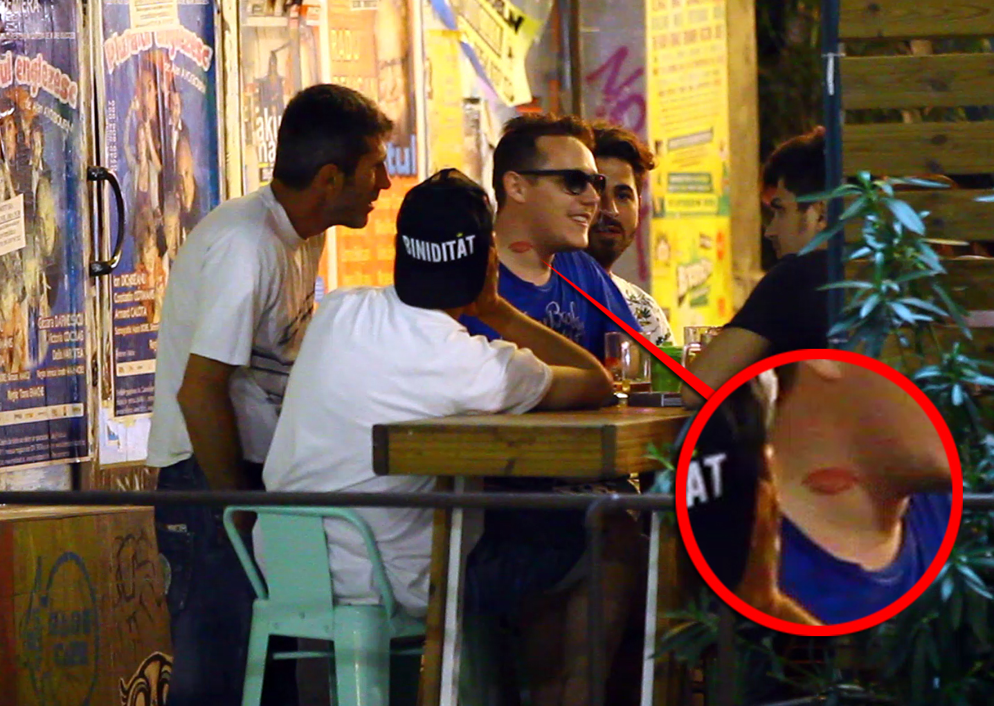 Tanarul si-a desenat doua buze chiar pe gat