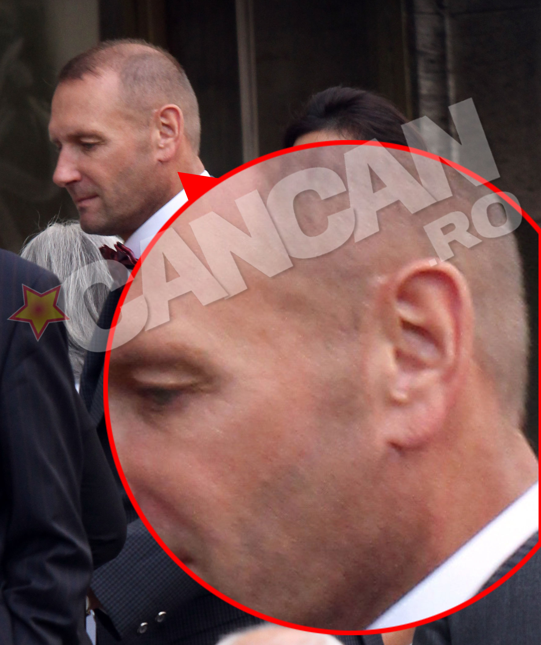 Exact langa urechea lui Catarama se vede o cicatrice