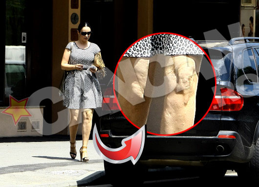 Pana si defectele le impart. Picioarele Andreei au aceeasi problema ca ale Laviniei