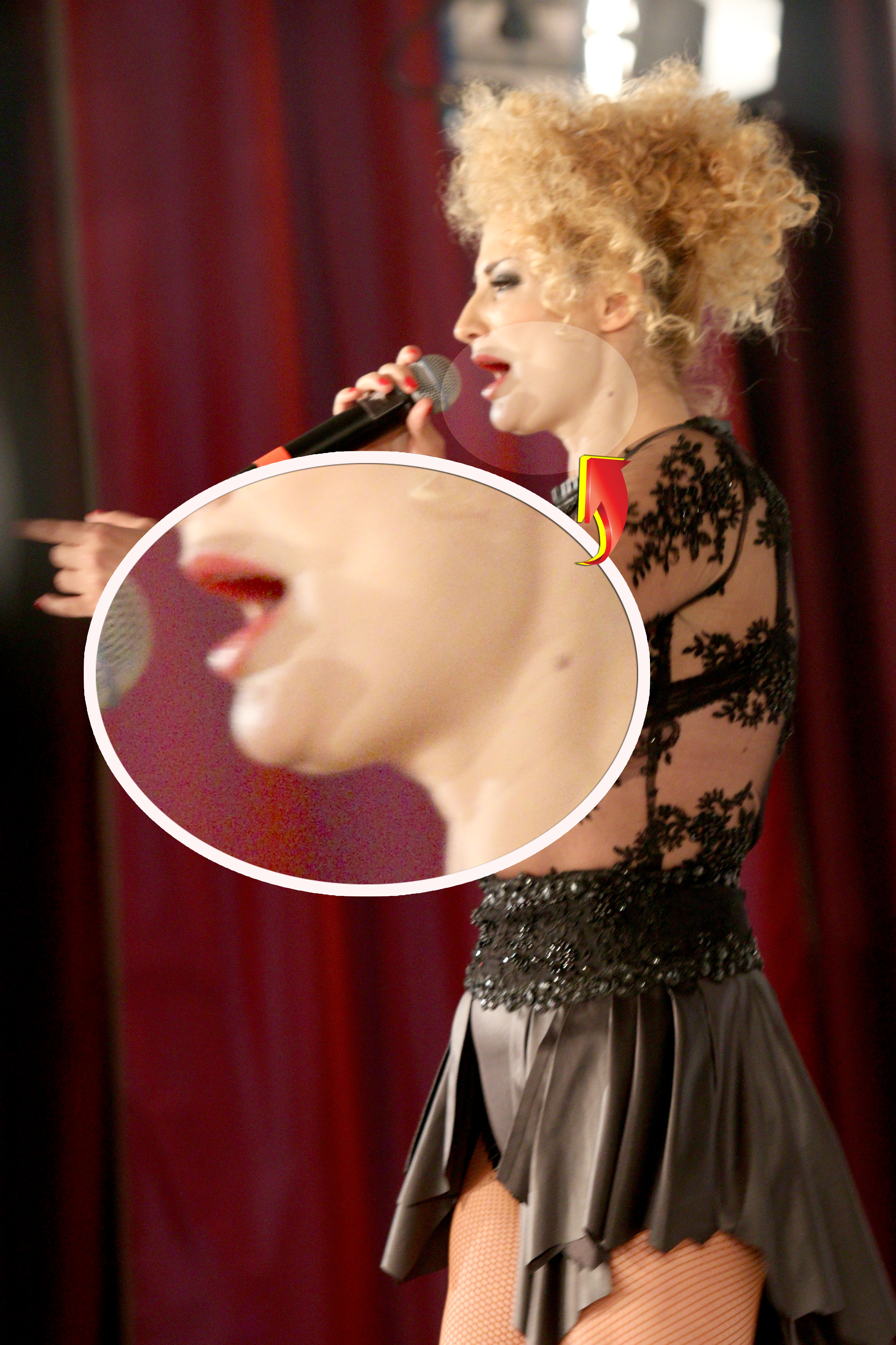 Juliei i se vedea gusa cu ochiul liber