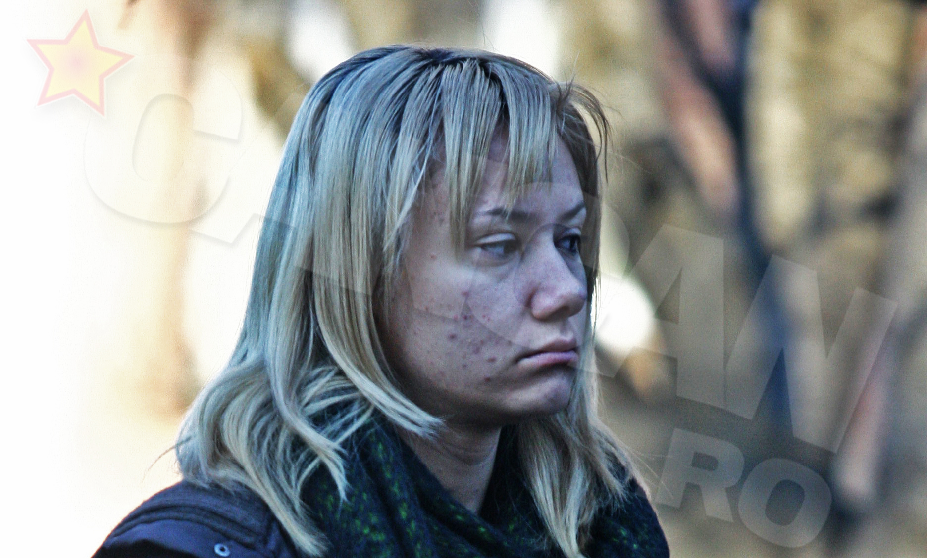 Asa arata tenul Oanei in anul 2005, cand avea grave probleme cu acneea