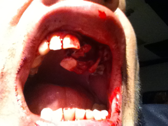 Asa arata impresarul Denisei la scurt dupa ce a fost lovit de unul din instrumentistii lui Florin Salam