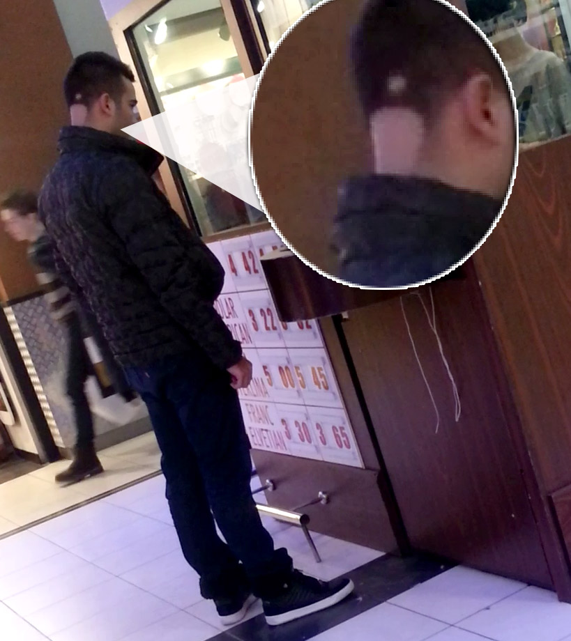 Raducu Mazare isi pierde podoaba capilara