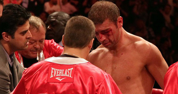 Bute a terminat meciul plin de sange