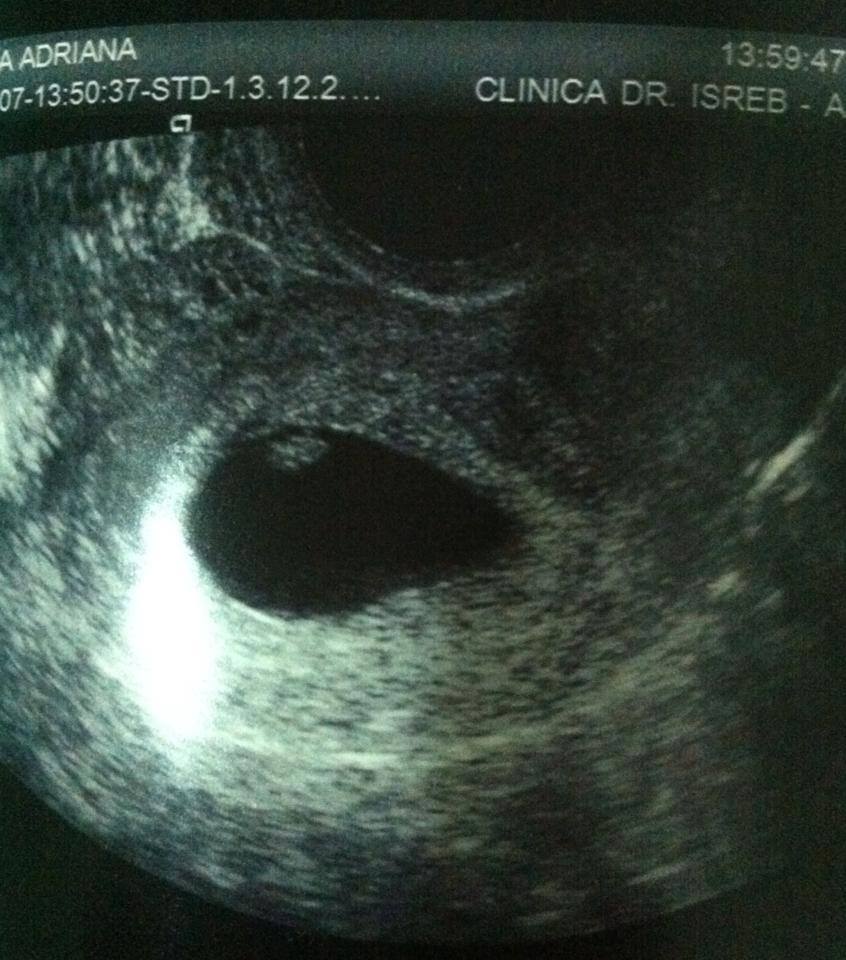 Costin a fost atat de fericit ca va deveni tata incat si-a postat pe Facebook prima ecografie a copilului sau sursa: Facebook