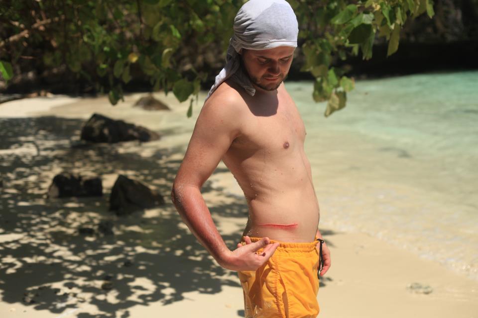 La filmarile Annei Lesko din Thailanda, Alex Ceausu s-a ranit destul de grav sursa: arhiva personala