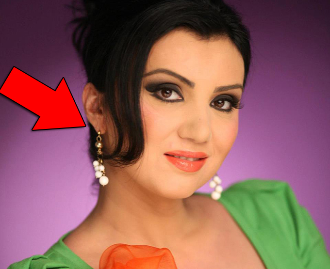 Bahmu are aceeasi problema, dar la urechea dreapta