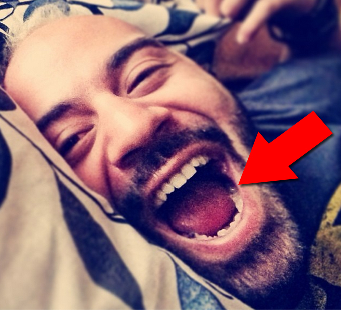 Matteo s-a pozat cascand, cu... cariile la vedere