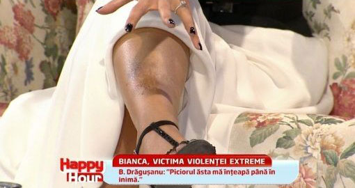 Bianca a inceput sa isi arate anul trecut la TV vanataile de pe picioare